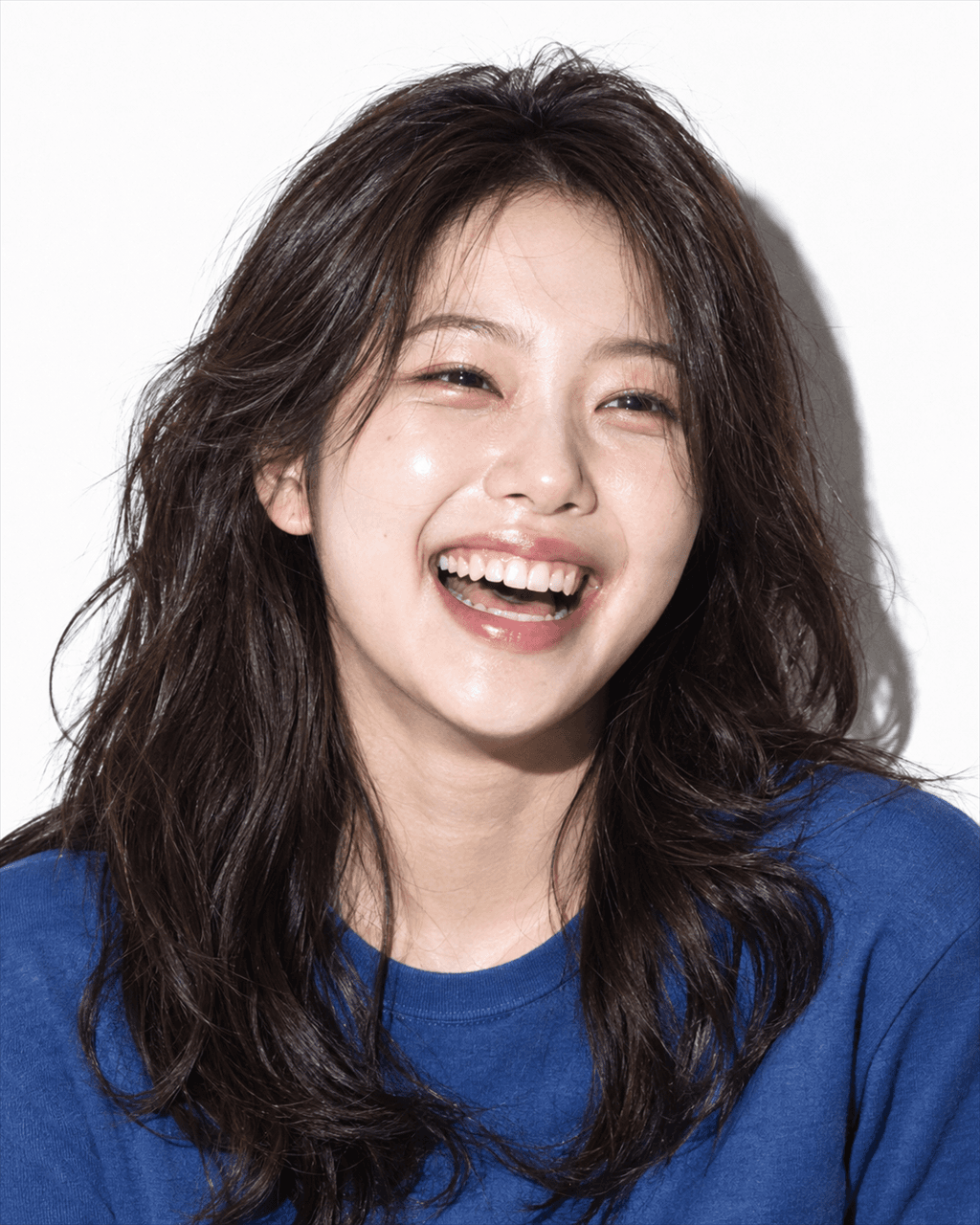 지방이식 대표 이미지