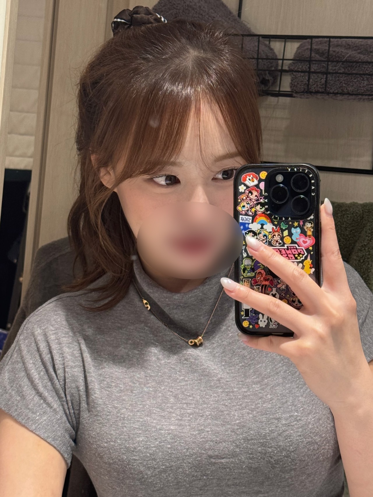 눈성형 고객 셀피 후기