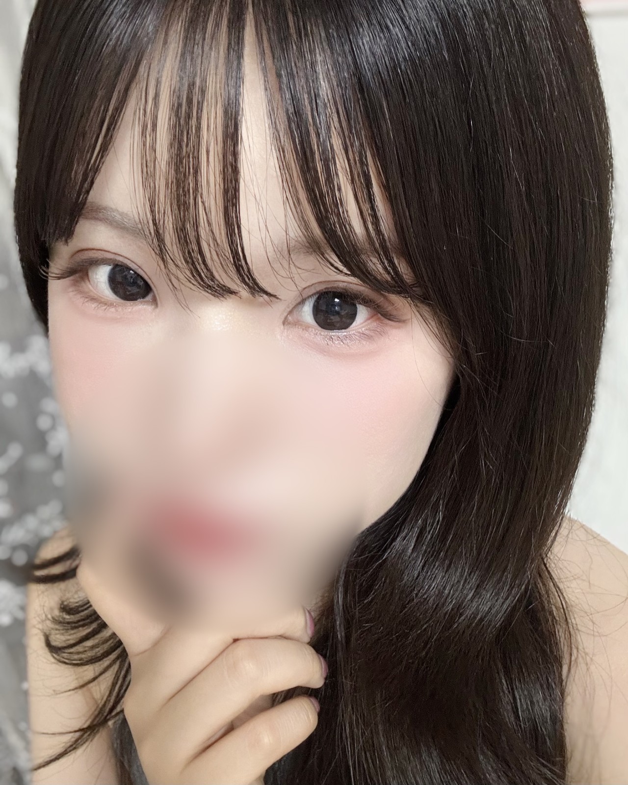 눈성형 고객 셀피 후기